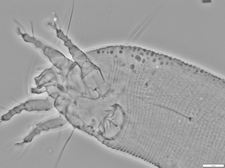 Microscope grey photo showing insect