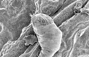 Scanning electron microscopy image of a tiny mite